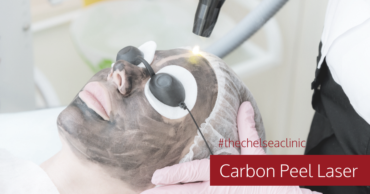 Carbon Peel Laser | Chelsea Clinic