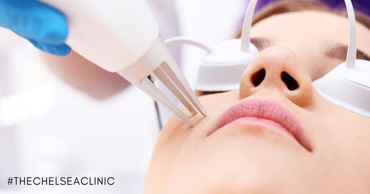 IPL + ND:YAG LASER | Chelsea Clinic