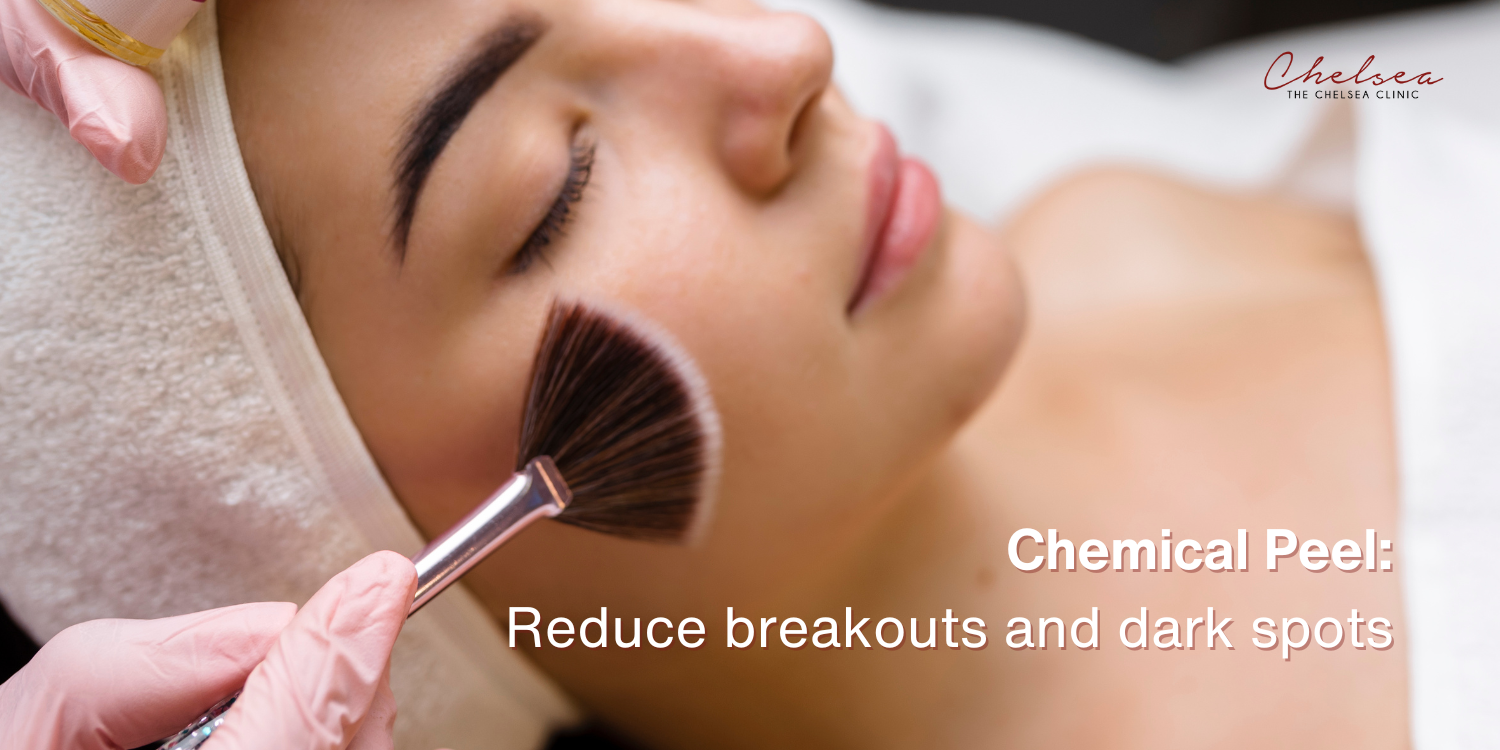 chemical peel, the chelsea clinic