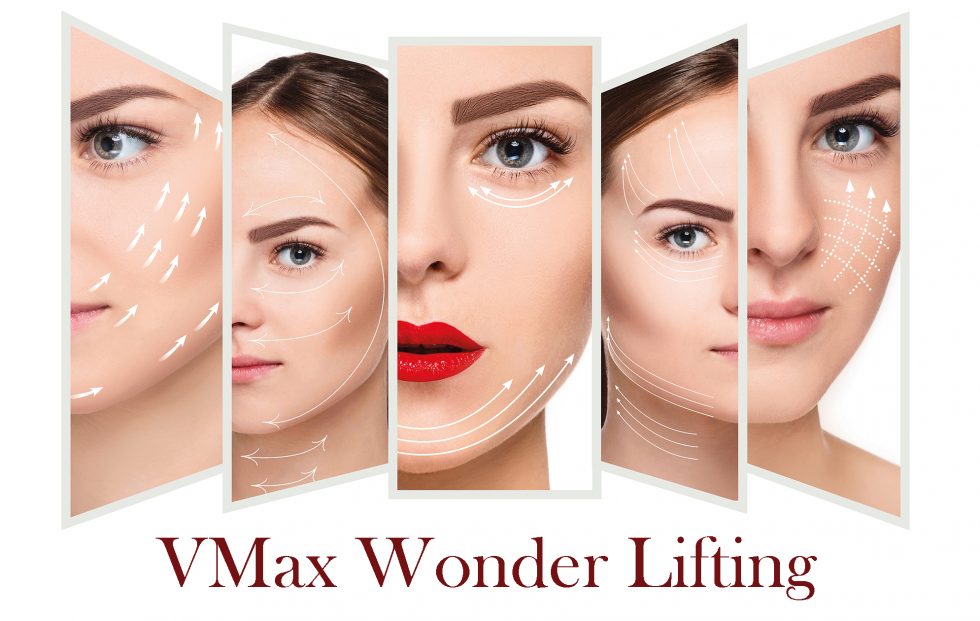 Vmax Wonder Lifting | Chelsea Clinic