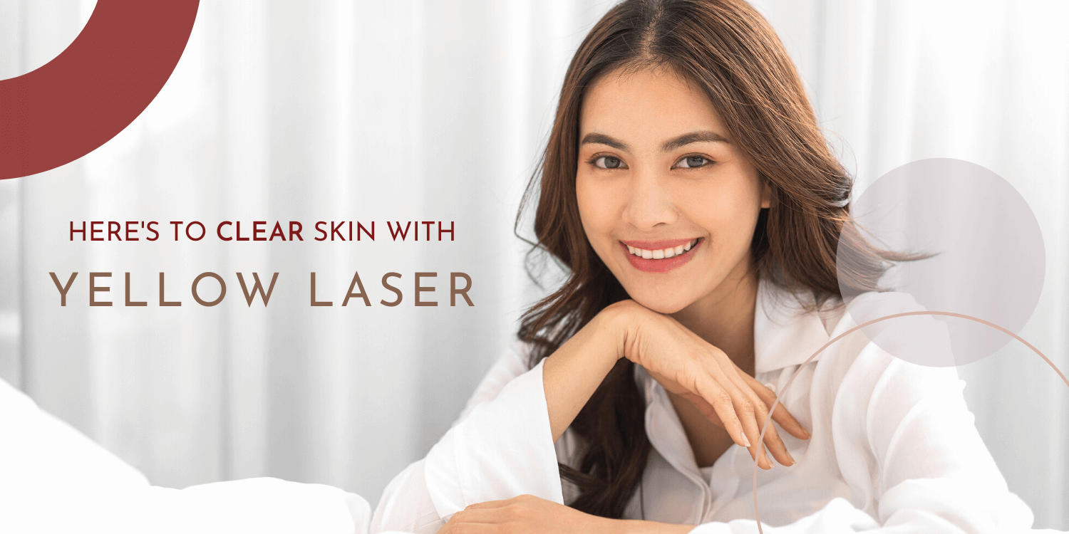 Pro Yellow Laser | Chelsea Clinic